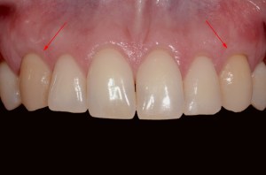 before and after dental procedure in greater houston