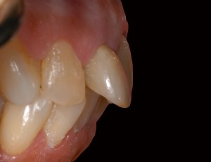 before and after dental procedure in greater houston