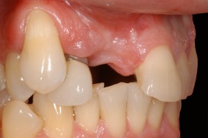 before and after dental procedure in greater houston
