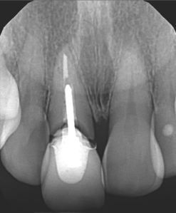 before and after dental procedure in greater houston