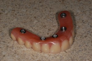 before and after dental procedure in greater houston